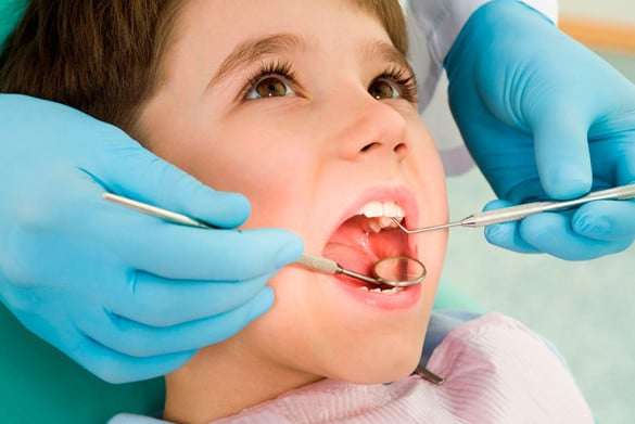 Лечение глубокого кариеса постоянных зубов у детей